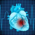 5 Warning Signs Your Heart Sends That You Should Never Ignore, According to Top U.S. Cardiologist