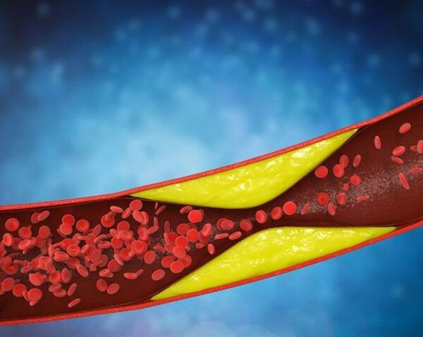 8 Morning Habits That May Be Silently Raising Your LDL Cholesterol