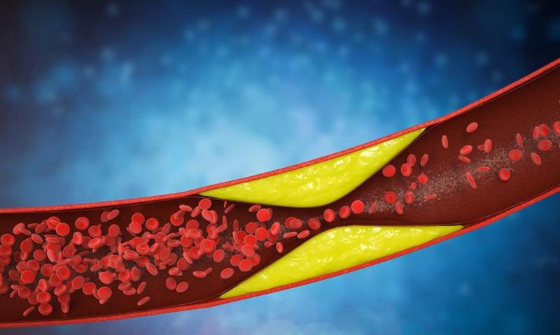 8 Morning Habits That May Be Silently Raising Your LDL Cholesterol