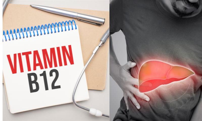 Can Vitamin B12 Deficiency Cause Fatty Liver Disease Causes, Symptoms & Treatment Explained