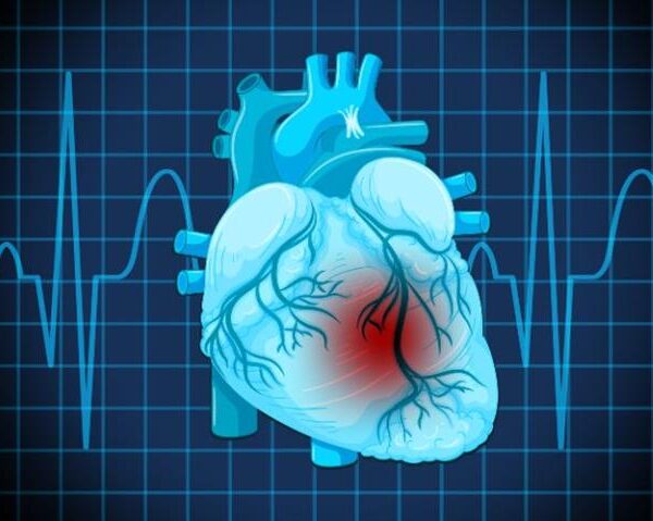 SGLT2 Inhibitors and Their Role in Lowering Heart Failure Risk in Type 2 Diabetes Mellitus