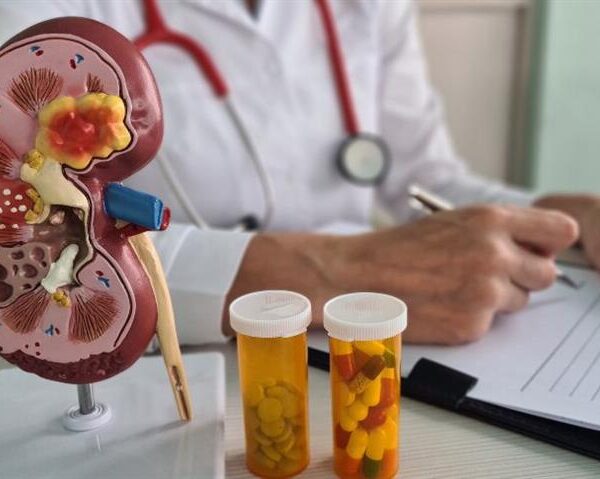 Ankylosing Spondylitis Associated With Increased Risk of Kidney Disease, Study Shows
