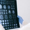 AI-Powered Medical Imaging Solutions Expected to Surpass Traditional Systems