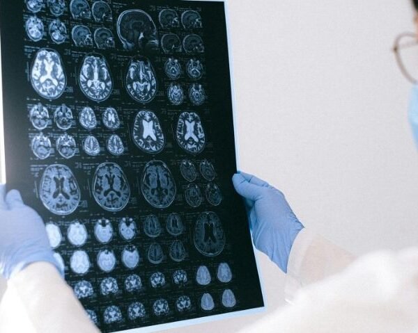 AI-Powered Medical Imaging Solutions Expected to Surpass Traditional Systems