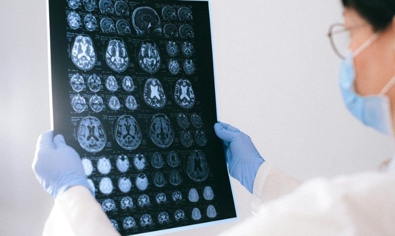 AI-Powered Medical Imaging Solutions Expected to Surpass Traditional Systems