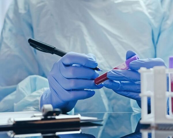 Molbio Diagnostics Raises ₹281 Crore in Anchor Investment Ahead of ₹940 Crore IPO